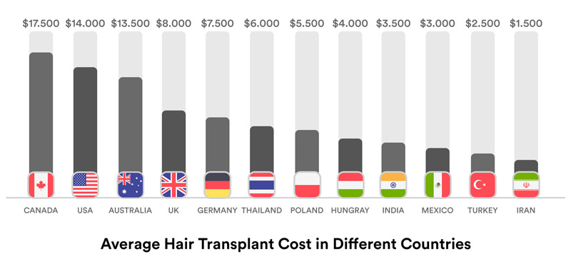 Hair transplant cost comparison